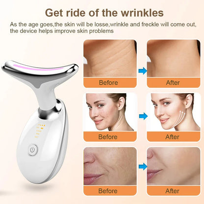EMS Microcurrent Face &amp; Neck Lifting Massager with LED Ligh